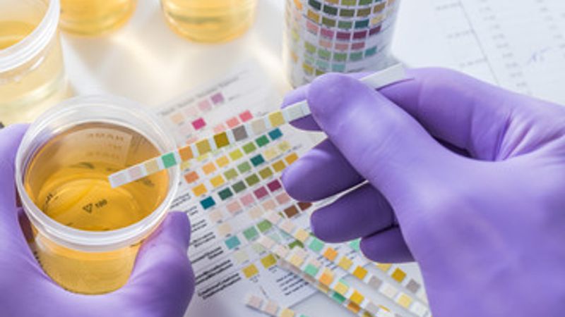 glucose in urine test