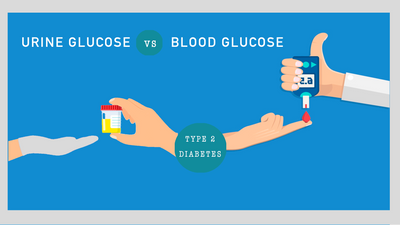 Sugar in Urine - Everything You Need to Know - Sugar.Fit's photo