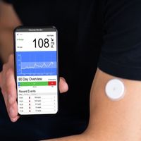 What is CGM? (Continuous Glucose Monitoring) - Sugar.Fit's photo