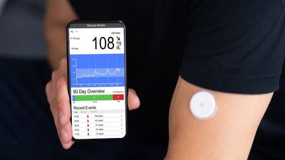 What is CGM? (Continuous Glucose Monitoring) - Sugar.Fit's photo