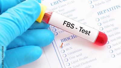 Fasting Blood Sugar Level - Sugar.Fit's photo