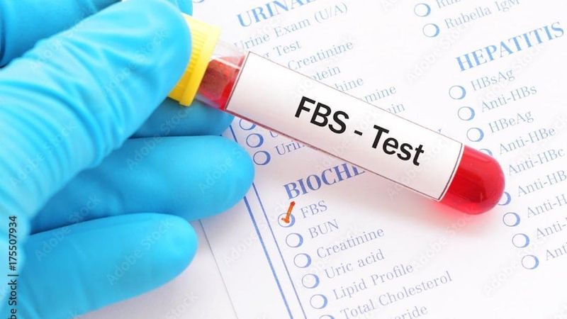 fasting blood sugar level