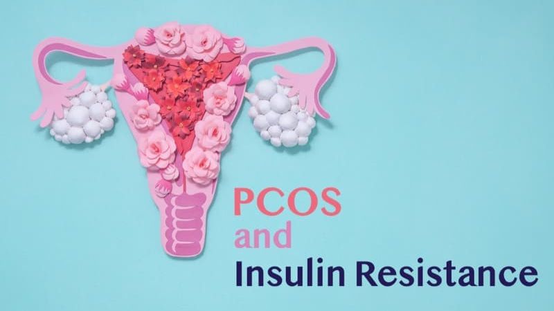 Link Between PCOS and Insulin Resistance