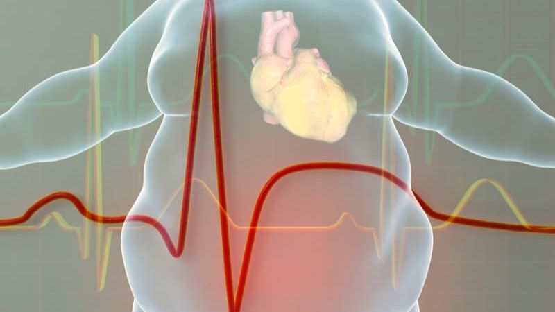 Obesity Ins and Outs