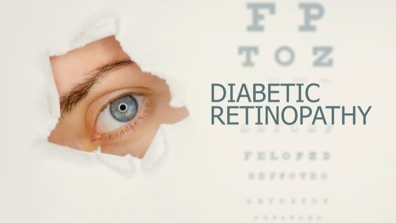 Foods To Prevent Diabetic Retinopathy