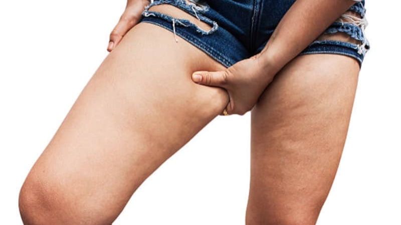 Exercises to Lose Thigh Fat