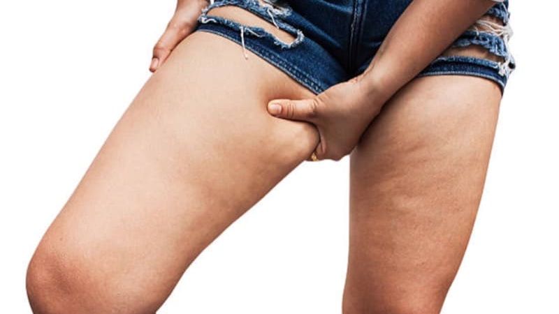 Inner Thigh Fat: 10 Exercises That You Can Get Slim Inner Thighs