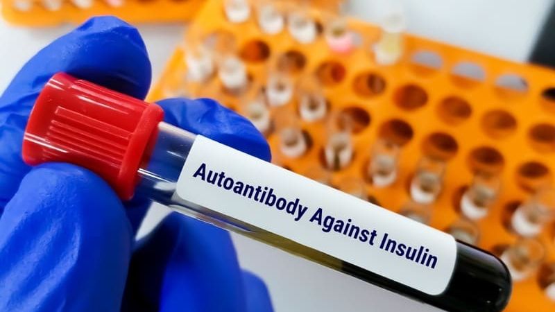 Testing for Diabetes Associated Antibodies
