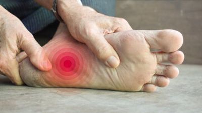 Diabetic Foot Ulcers - Symptoms & Diagnosis - Sugar.Fit's photo
