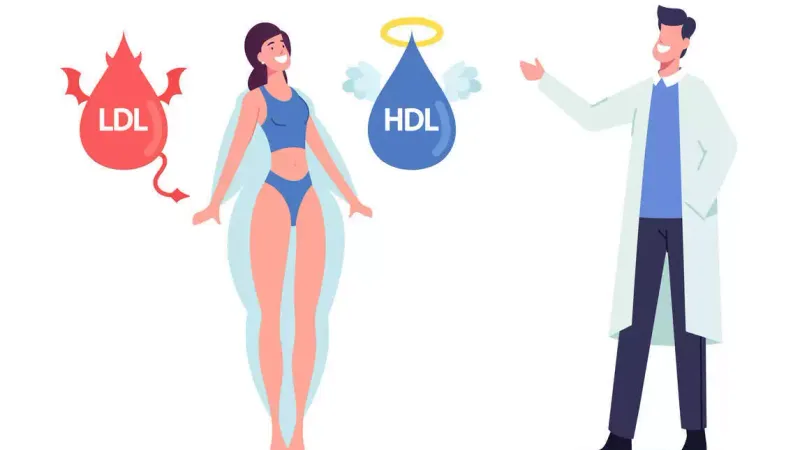 High Cholesterol Treatment